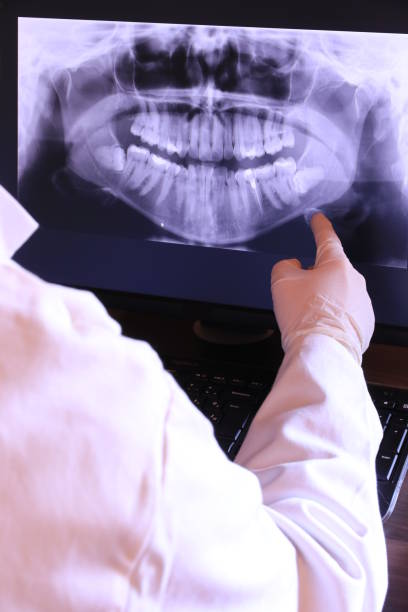 Best Emergency Treatment for Dental Infections or Abscesses in Fairmount, NY